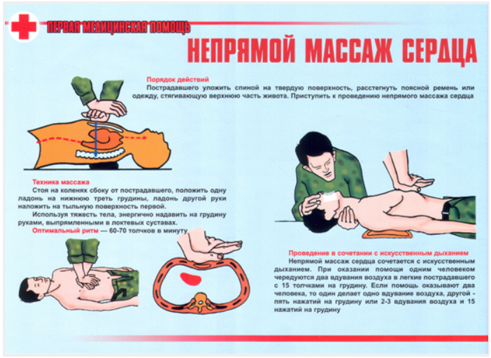 Последовательность действий при массаже Последовательность действий при массаже